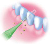 San-Ai Dental Pro Interdental Brush